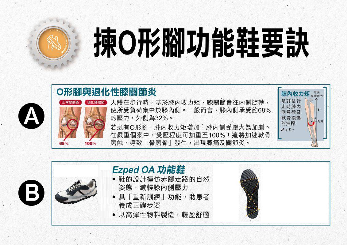 O形腳 O型腳 O形腳 O型腳