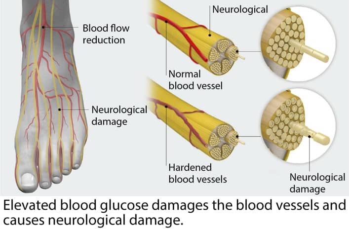Assessment of Blood Circulation and Nerve Health in the Feet