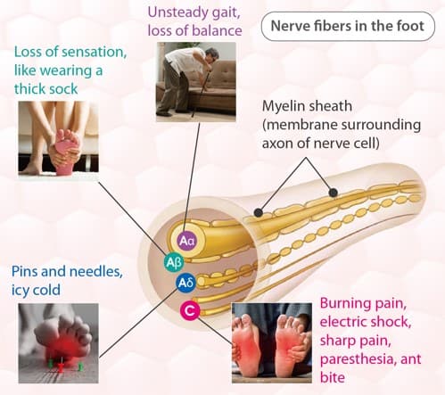 Assessment of Blood Circulation and Nerve Health in the Feet