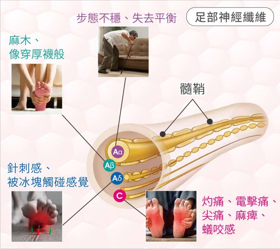 足部血液循環與神經健康評估 足部血液循環與神經健康評估