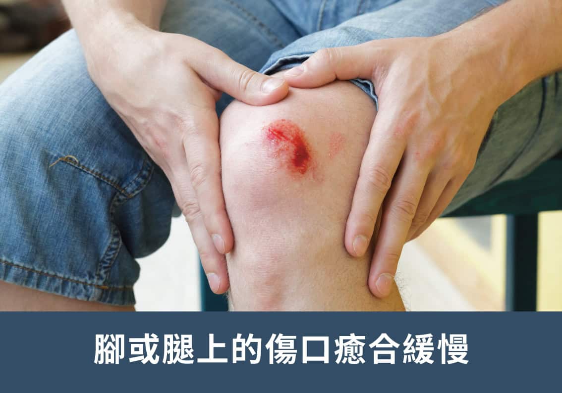 足部血液循環與神經健康評估 足部血液循環與神經健康評估