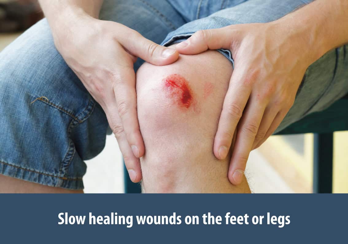 Assessment of Blood Circulation and Nerve Health in the Feet