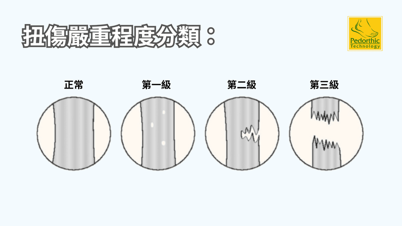 足踝扭傷 全指南：從緊急處理到完全復健，一步一步帶你正確康復