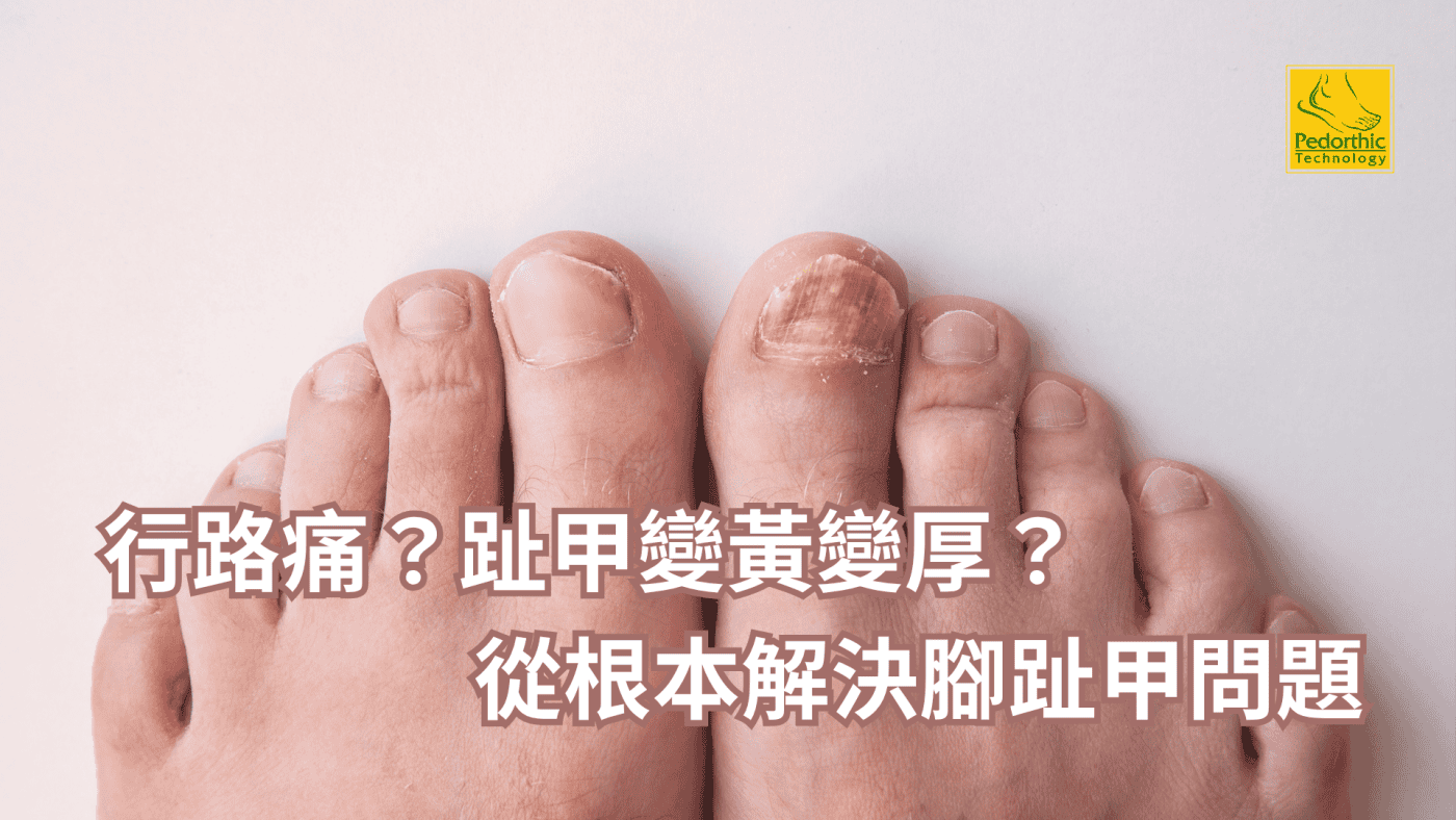 腳趾甲痛又醜,是嵌甲還是灰指甲?一篇搞懂原因、症狀與正確處理 腳趾甲痛又醜,是嵌甲還是灰指甲?一篇搞懂原因、症狀與正確處理